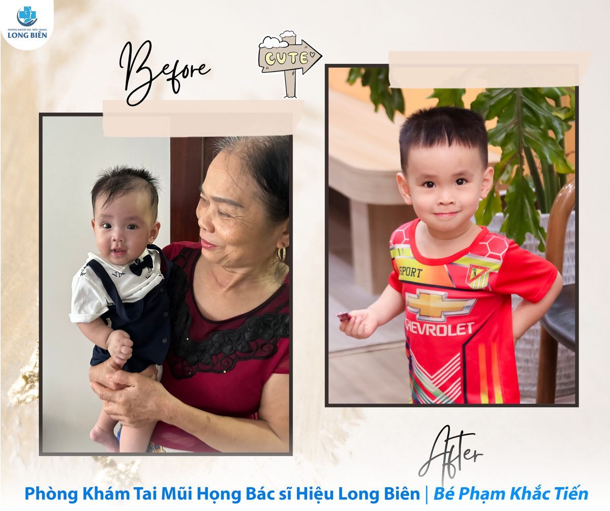 Bé lớn lên cùng Phòng Khám TMH Bác Sĩ Hiệu Long Biên