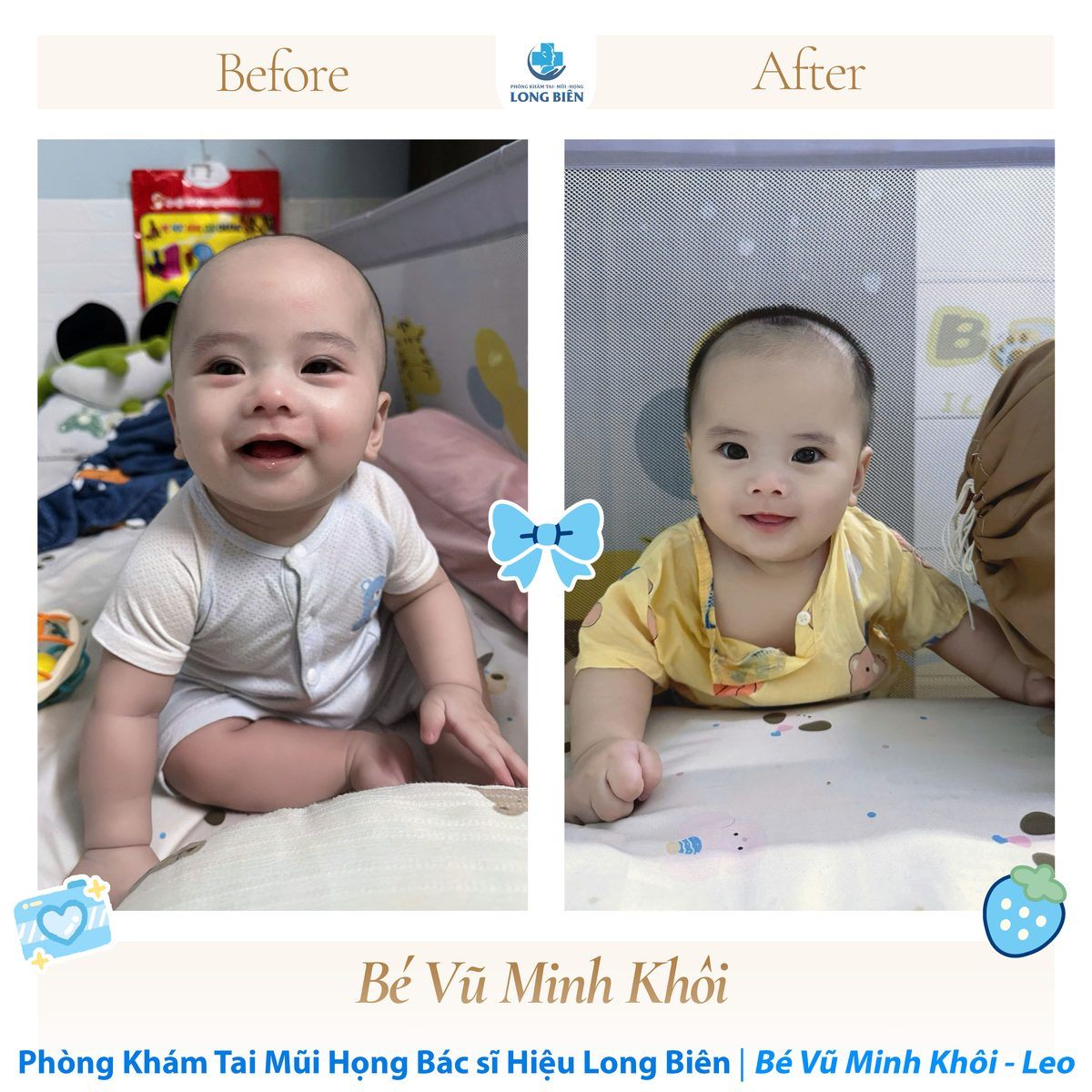 Bé lớn lên cùng Phòng Khám TMH Bác Sĩ Hiệu Long Biên