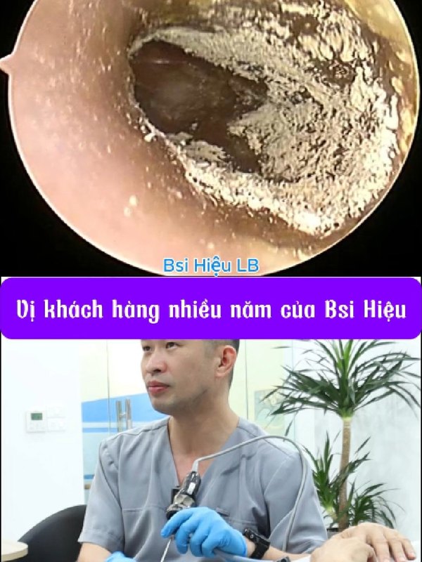 Vệ sinh tai cho vị khách quen nhiều năm
