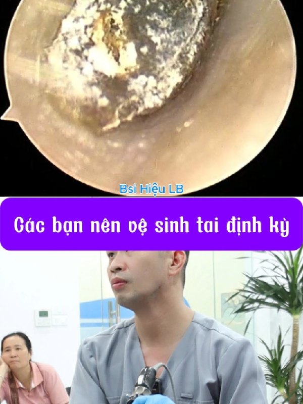 Vì sao nên vệ sinh tai định kỳ 3–6 tháng