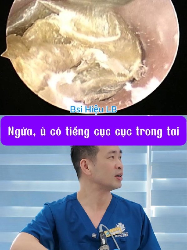Mới ù một ngày nhưng soi ra rất nhiều
