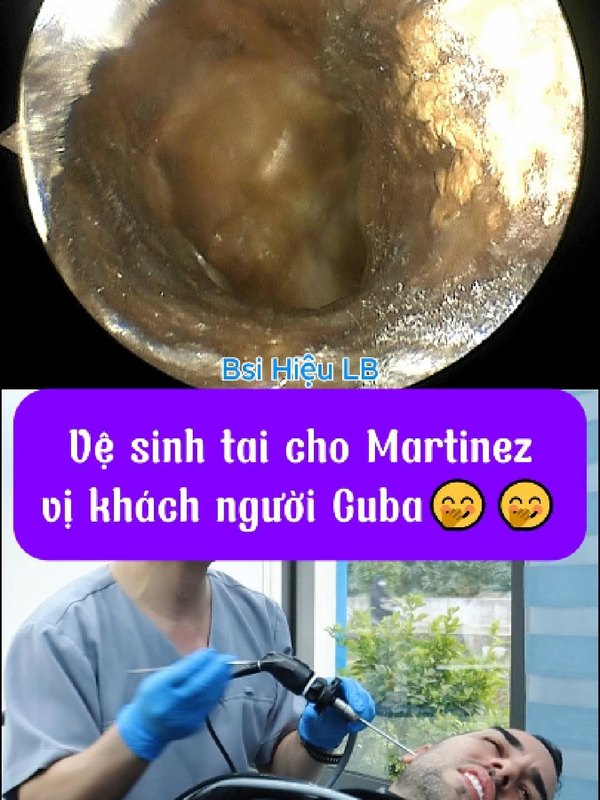 Martinez đau tai và ù tai suốt 2 tuần