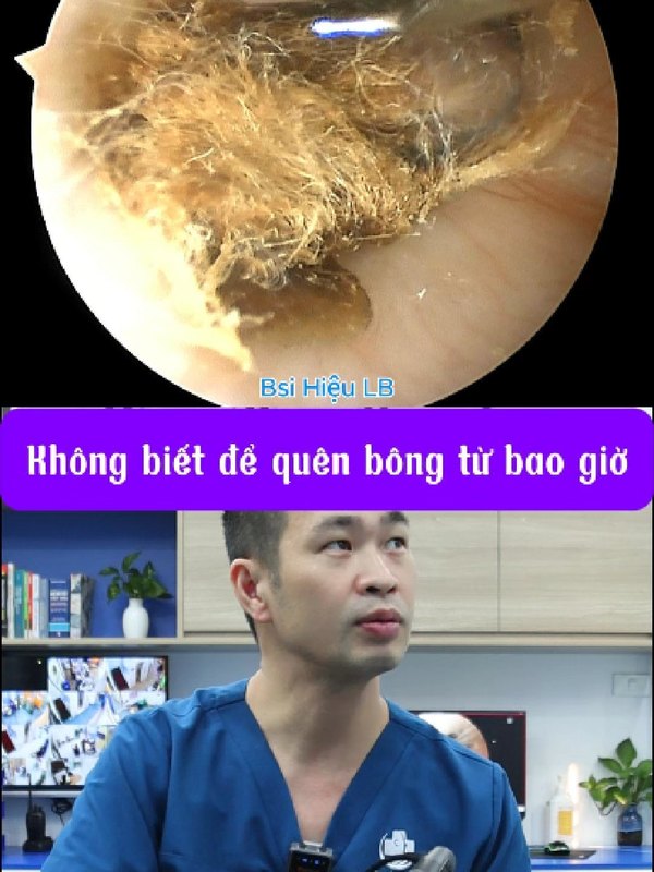 Khối bông để quên trong tai từ bao giờ