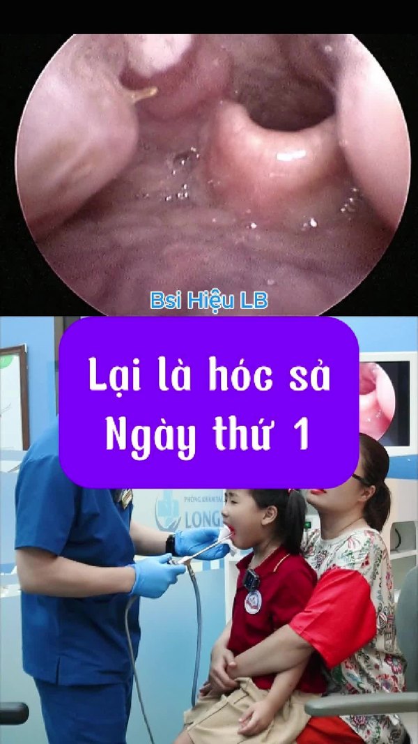 Bé hóc sả và đã hợp tác rất tốt