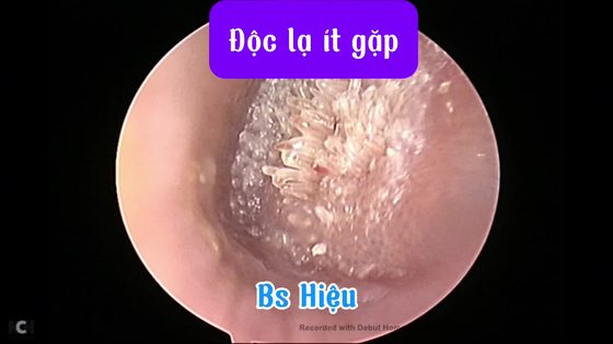 Một ca lâm sàng đặc biệt