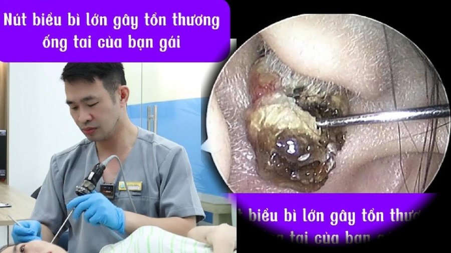 Bạn gái đã chịu đựng bao lâu rồi?