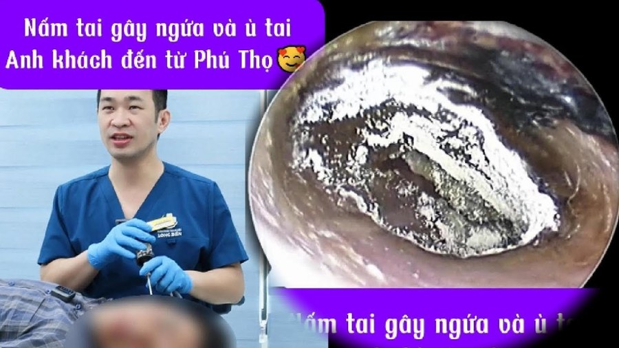 Nấm tai ở vị khách đến từ Phú Thọ