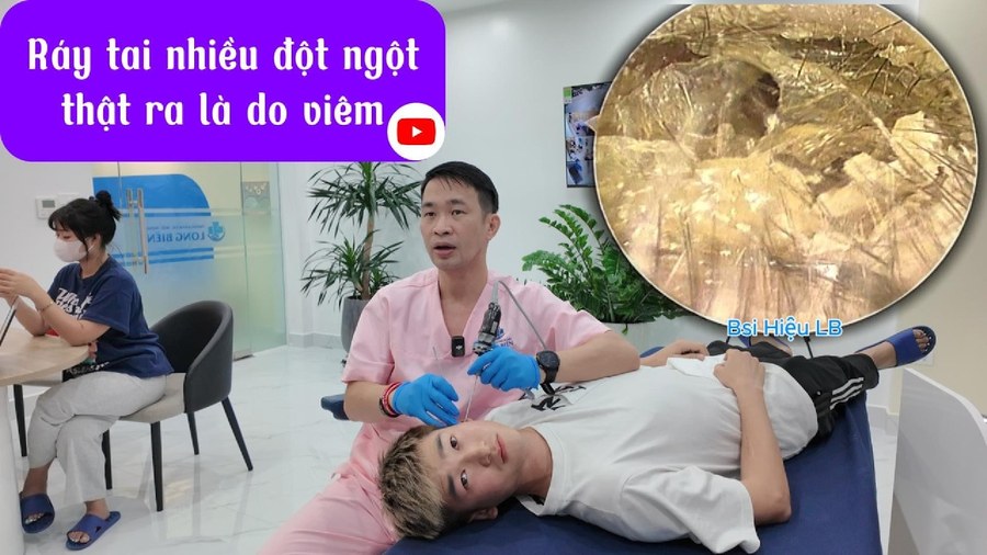 Ráy tai bỗng nhiên xuất hiện nhiều — đừng vội chủ quan