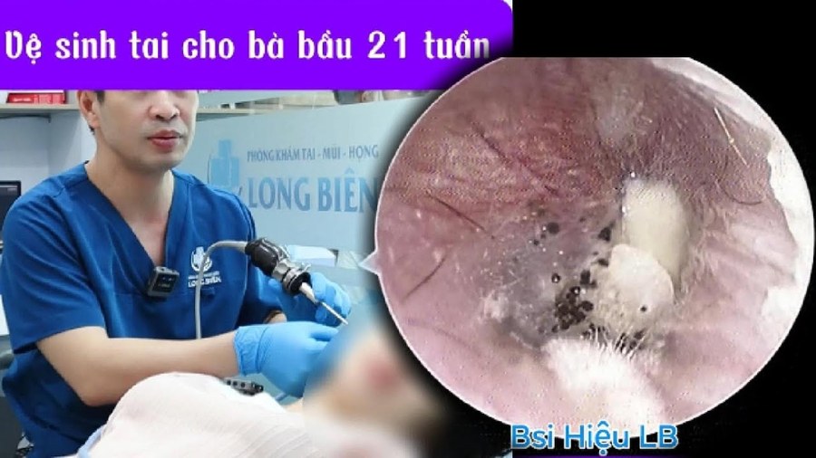 Vệ sinh nấm tai cho mẹ bầu 21 tuần