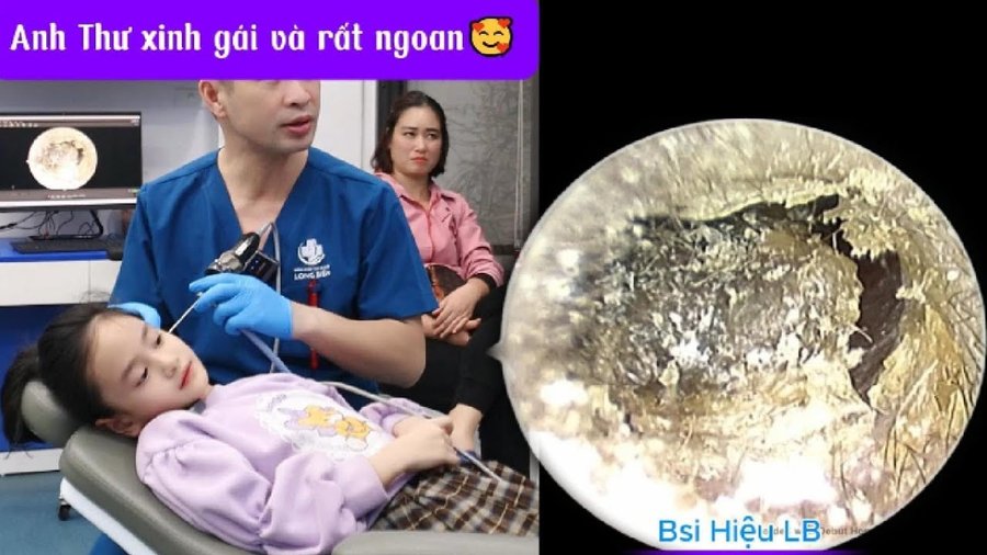 Vệ sinh tai cho trẻ nhỏ