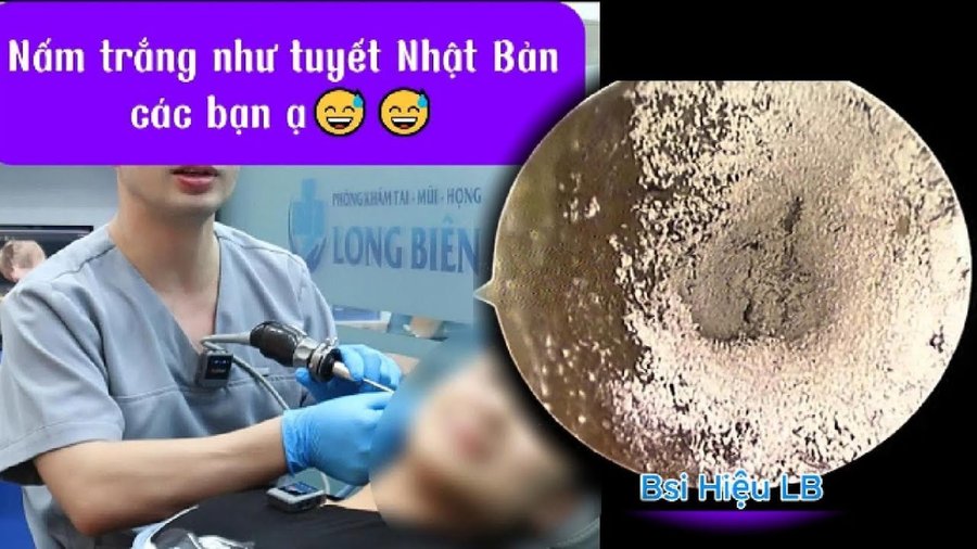 Nấm trắng như tuyết ở tai