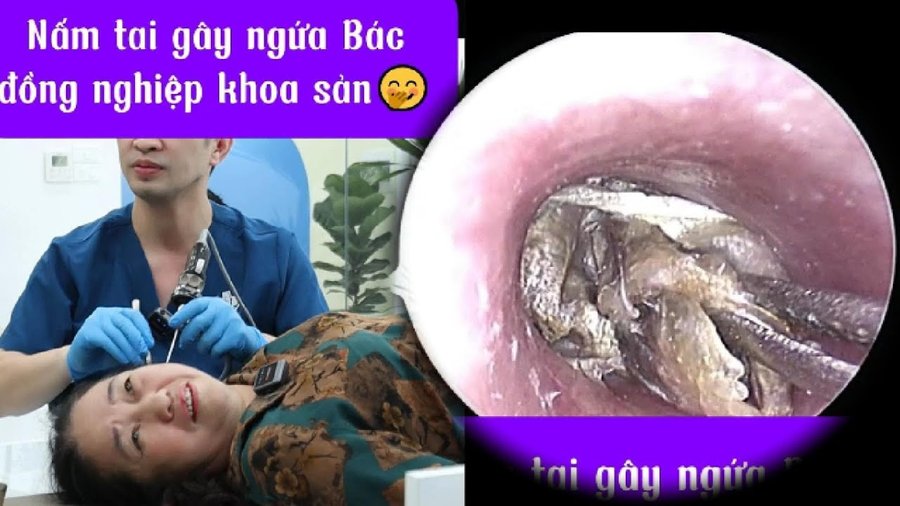 Nấm tai gây ngứa