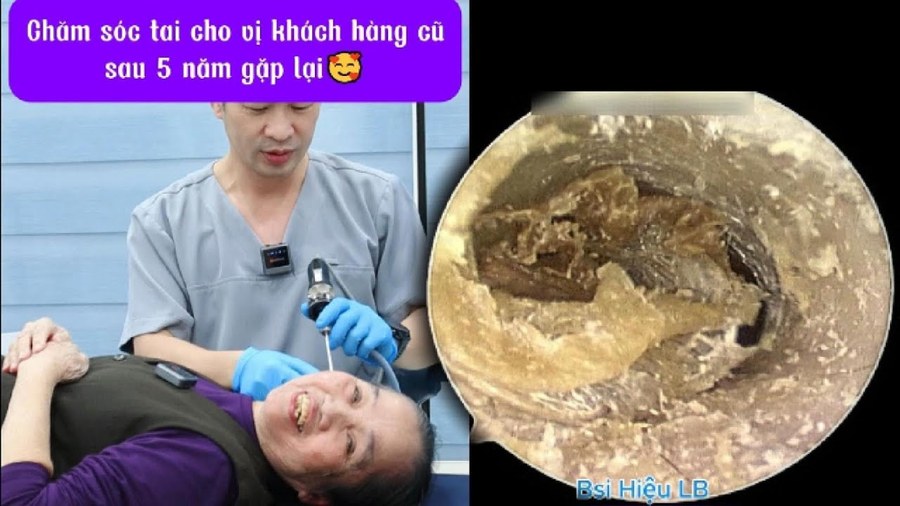 Chăm sóc tai cho khách hàng cũ sau 5 năm gặp lại